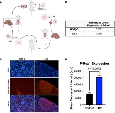Migration, invasion, and metastasis are mediated by P-Rex1 in neuroblastoma